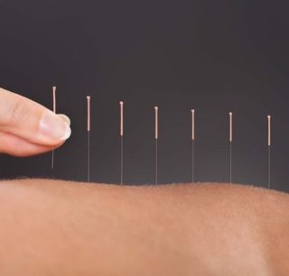 DID YOU KNOW. . . 
We offer acupuncture at our spa?
So many benefits!  Stop by or call 720.200.4255 to schedule.